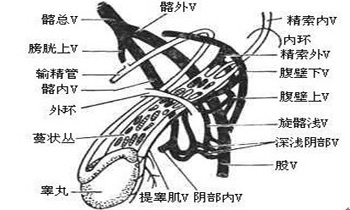 精索静脉曲张治疗需要多少钱